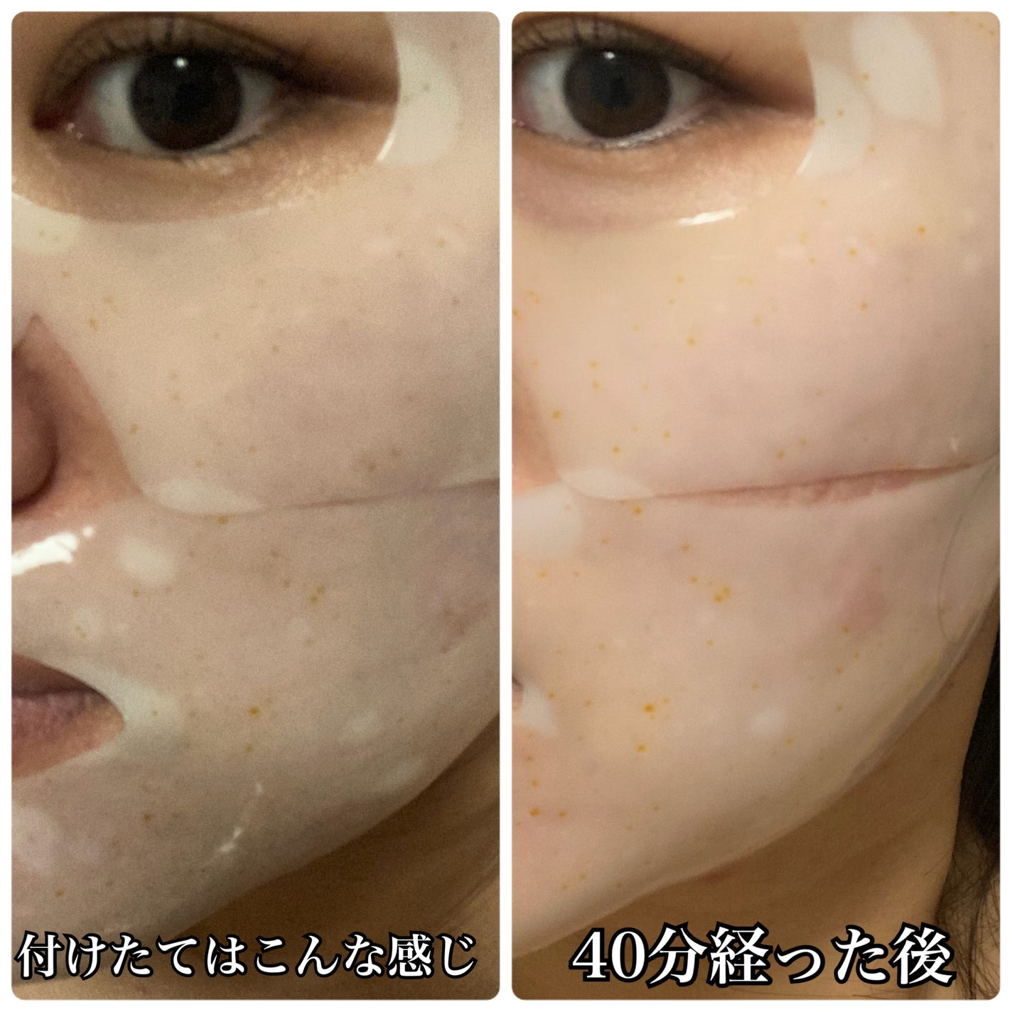 ユース ラディアンス ビタチノール セラム/primera/美容液を使ったクチコミ(4枚目)