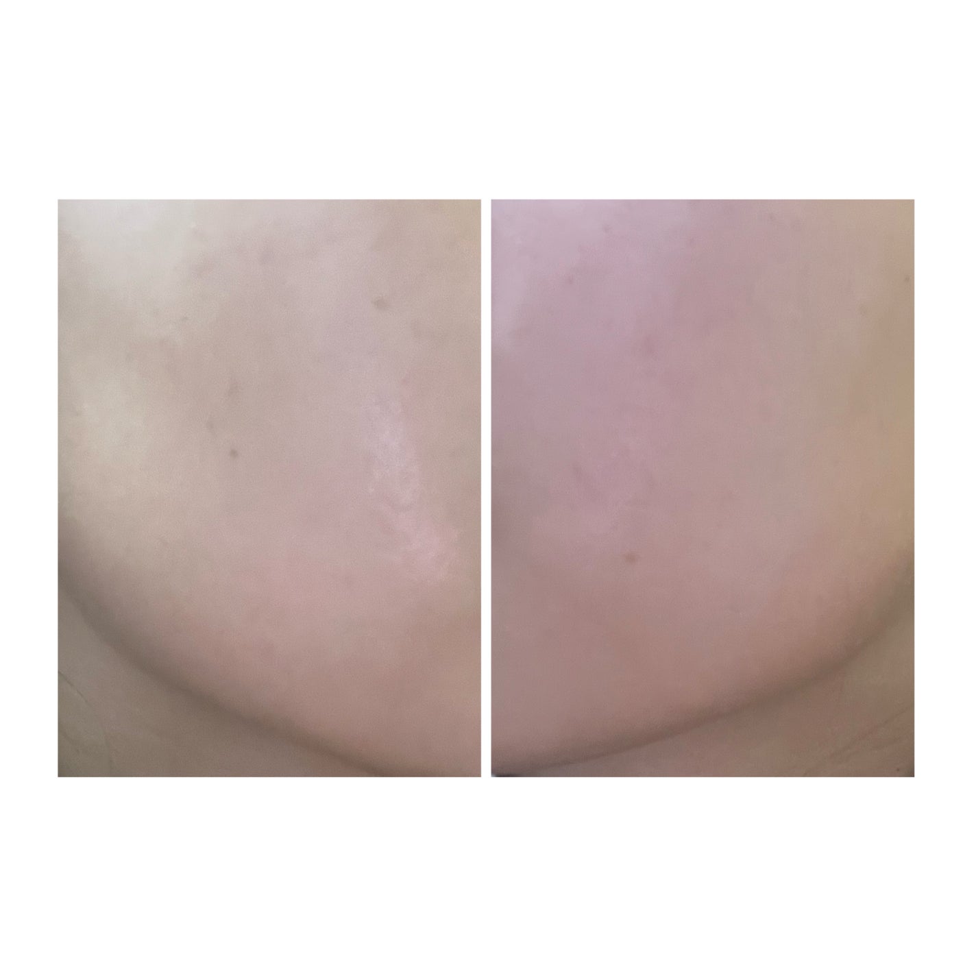 ぽむ on LIPS 「1枚目 2025.8.9エピデュオ 696日目2枚目 2025..」(4枚目)