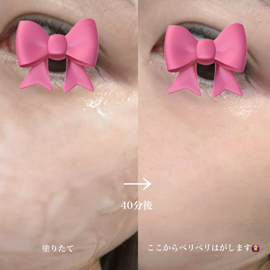 3D PDRN X コラーゲンアンプル/SKIN&LAB/美容液を使ったクチコミ（3枚目）