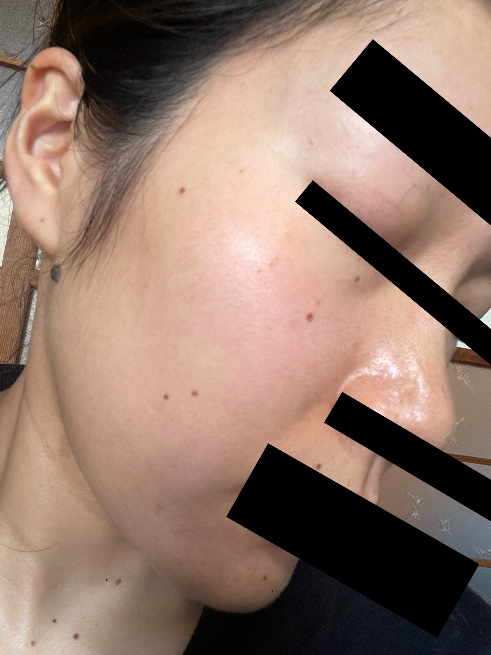 C25セラム ネオ/オバジ/美容液を使ったクチコミ（2枚目）