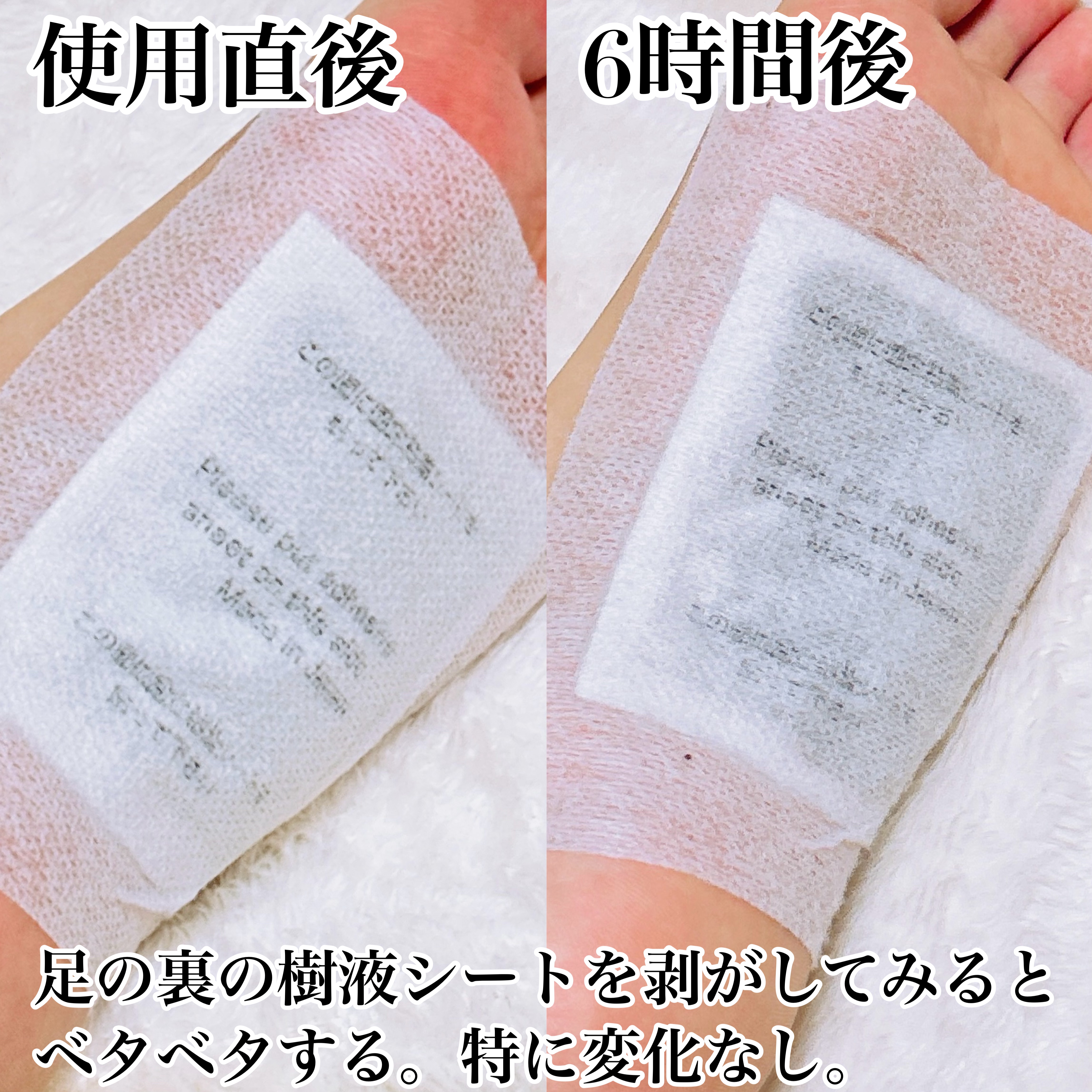 あしやすめ 足裏樹液シート/鎌倉ライフ/レッグ・フットケアを使ったクチコミ（3枚目）