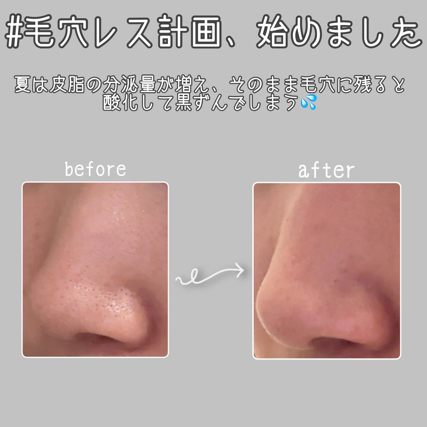 薬用 しみ 集中対策 美容液/メラノCC/美容液を使ったクチコミ(1枚目)