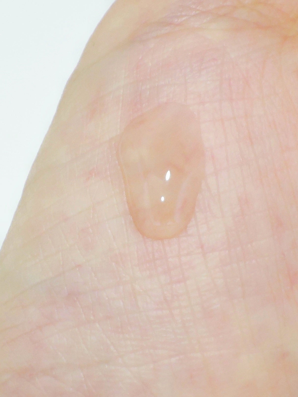 RXザ・アルファアルブチン2 ニキビ跡ケアセラム/COSRX/美容液を使ったクチコミ(4枚目)