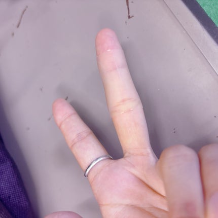 キズクイック/東洋化学/その他を使ったクチコミ(5枚目)