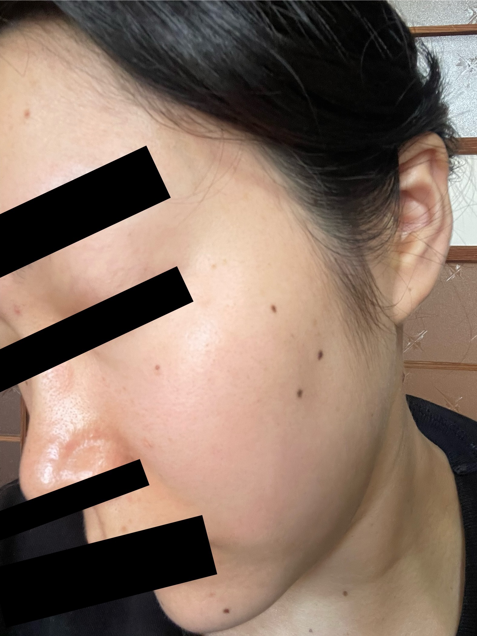 C25セラム ネオ/オバジ/美容液を使ったクチコミ（3枚目）