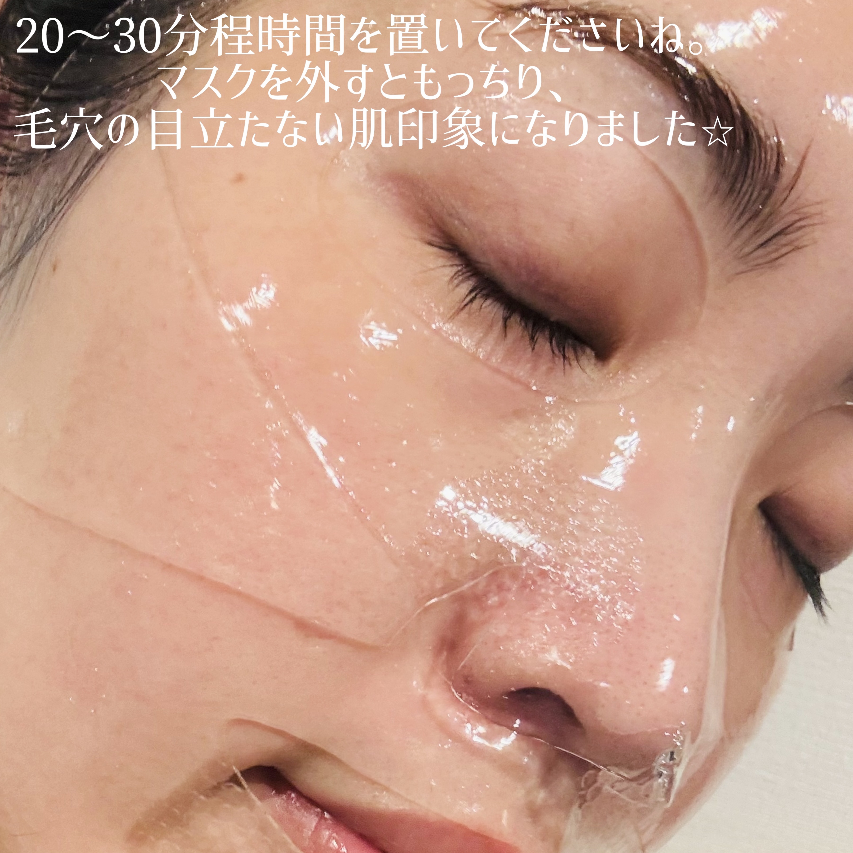 乳酸菌配合LHAピーリングマスク/0x cosmetic/シートマスク・パックを使ったクチコミ（3枚目）