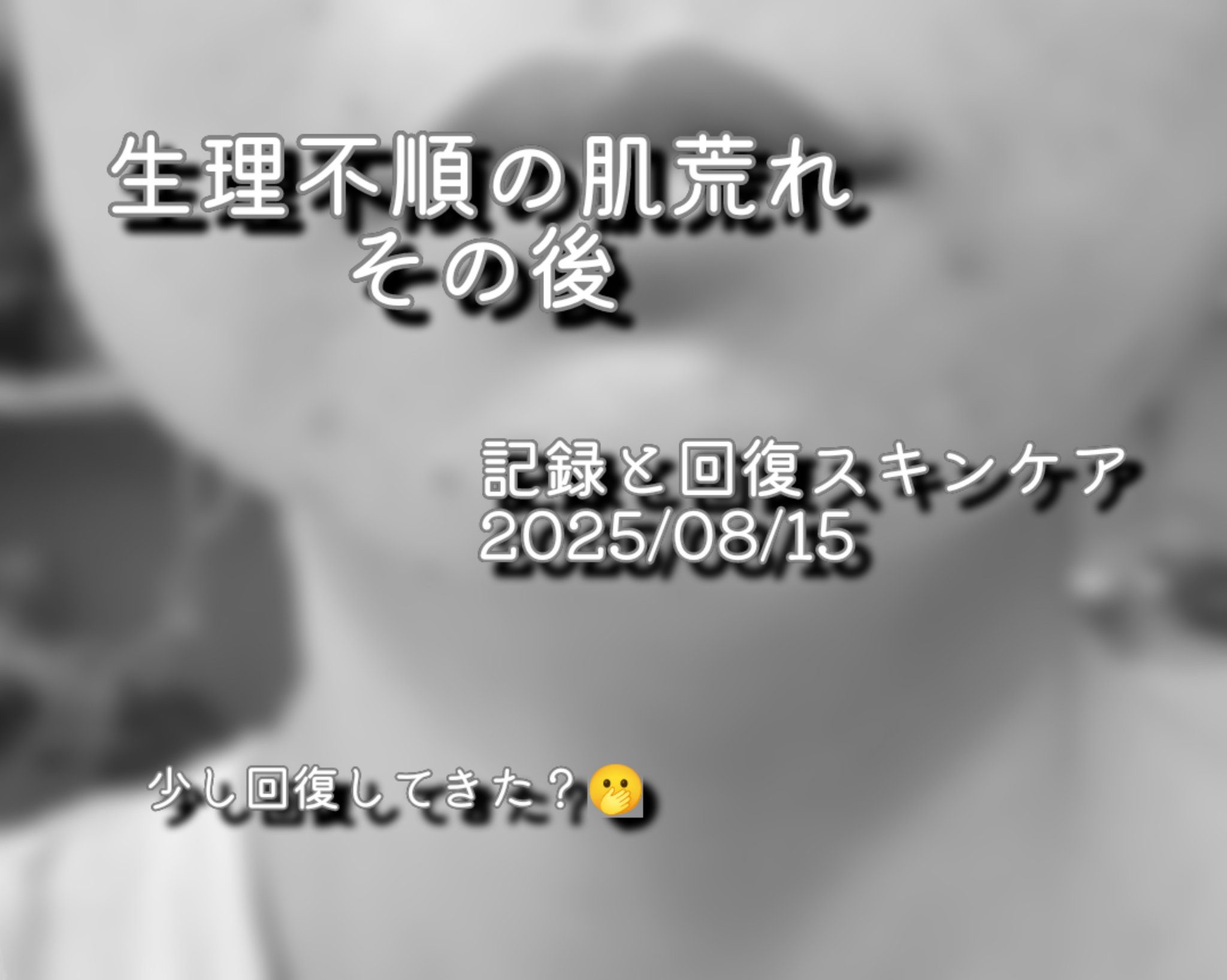 泡の洗顔料/カウブランド無添加/泡洗顔を使ったクチコミ（1枚目）