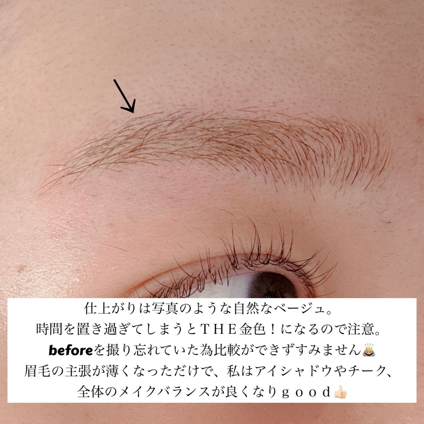 脱色クリーム 敏感肌用/エピラット/ムダ毛ケアを使ったクチコミ(4枚目)