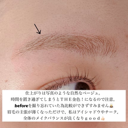 脱色クリーム 敏感肌用/エピラット/ムダ毛ケアを使ったクチコミ(4枚目)