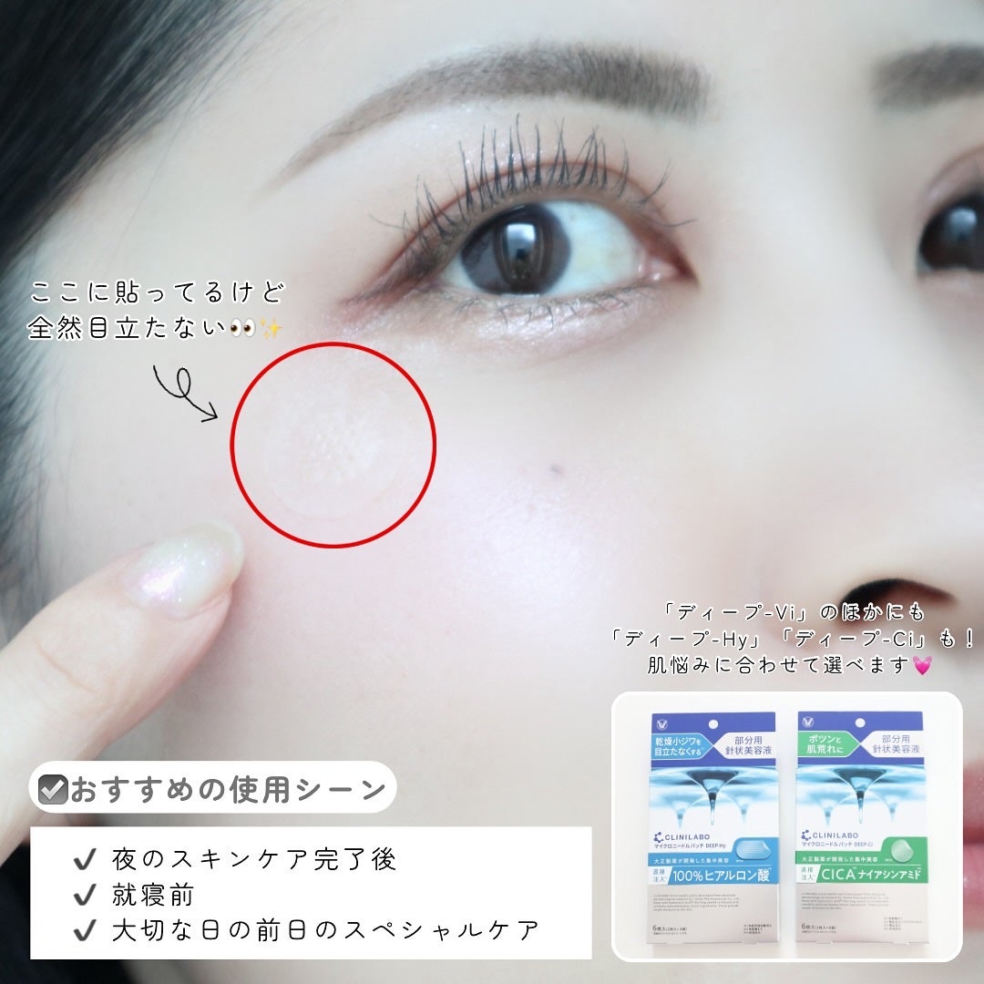 クリニラボ マイクロニードルパッチ ディープ-Vi/大正製薬/シートマスク・パックを使ったクチコミ(3枚目)