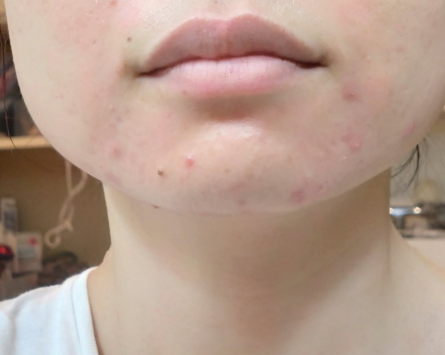 フェイシャル トリートメント エッセンス/SK-II/化粧水を使ったクチコミ(2枚目)