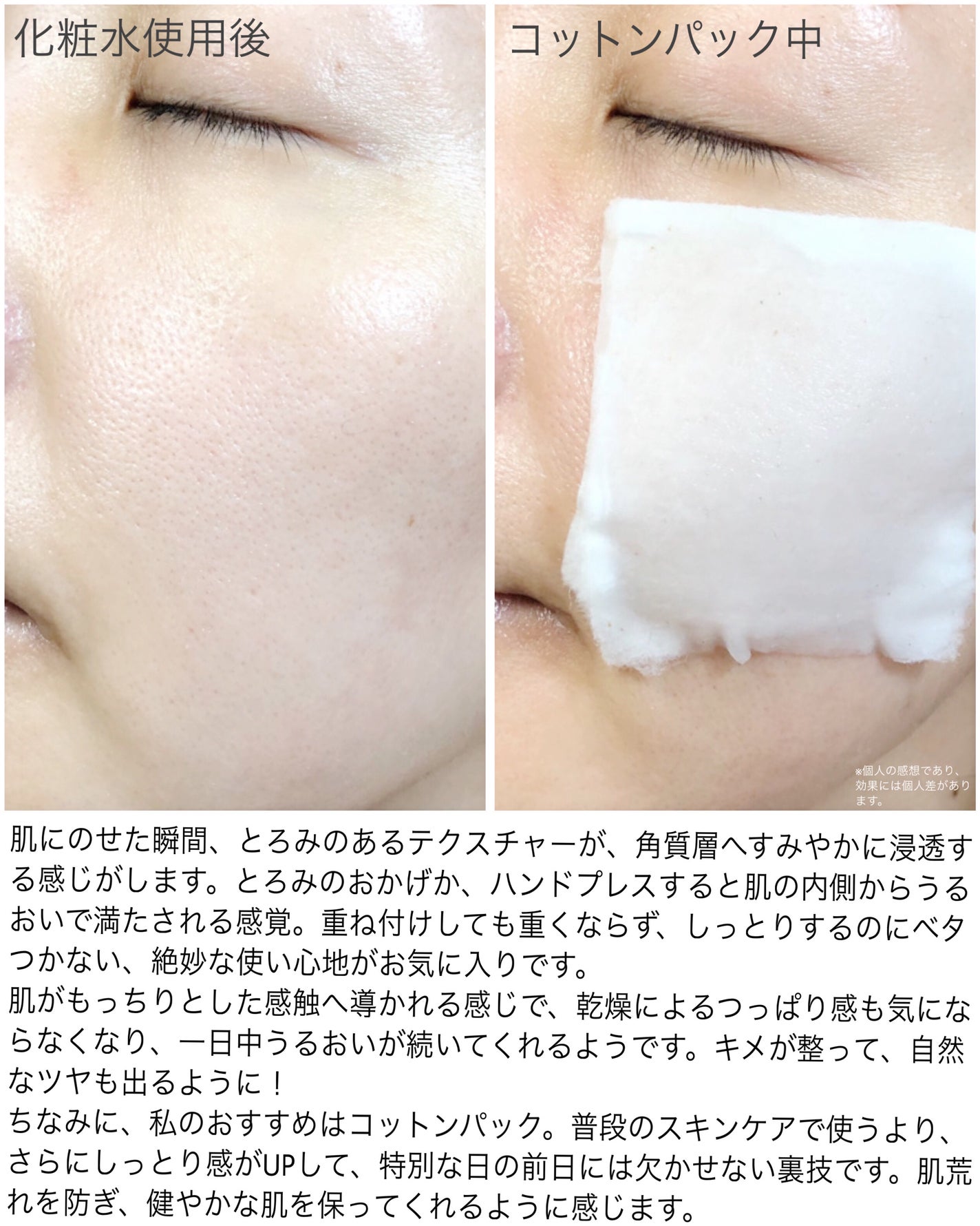 スージングアンプルトナー/pixelpure/化粧水を使ったクチコミ(3枚目)