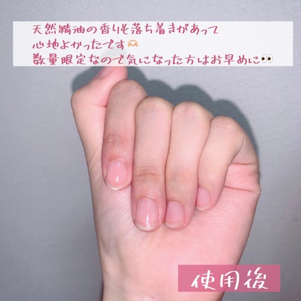 シュガードール モイストチャージオイル/シュガードール/ネイルオイル・トリートメントを使ったクチコミ(4枚目)