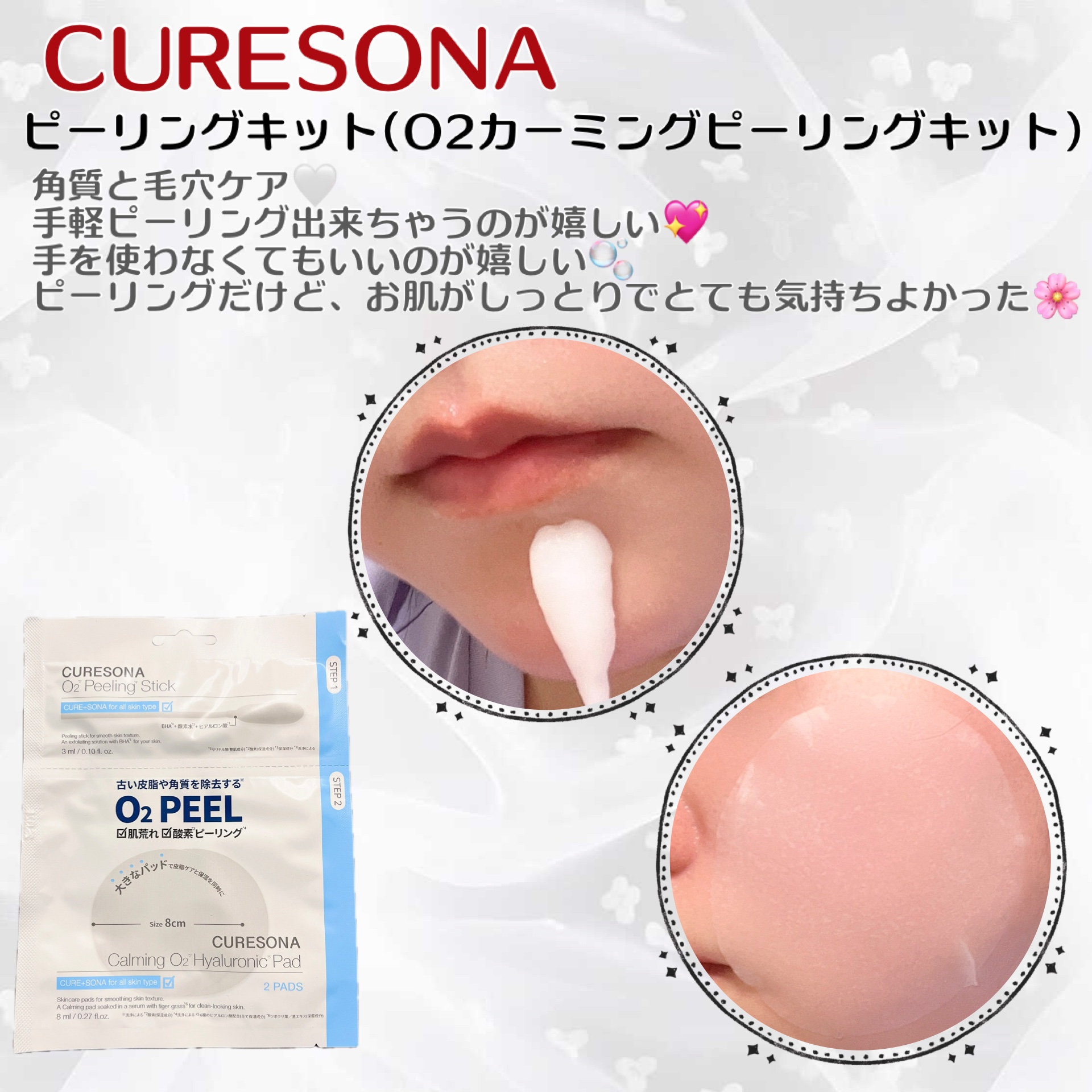 ピーリングキット カミングオーツーヒアルロニックパッド/CURESONA/スキンケアキットを使ったクチコミ（2枚目）