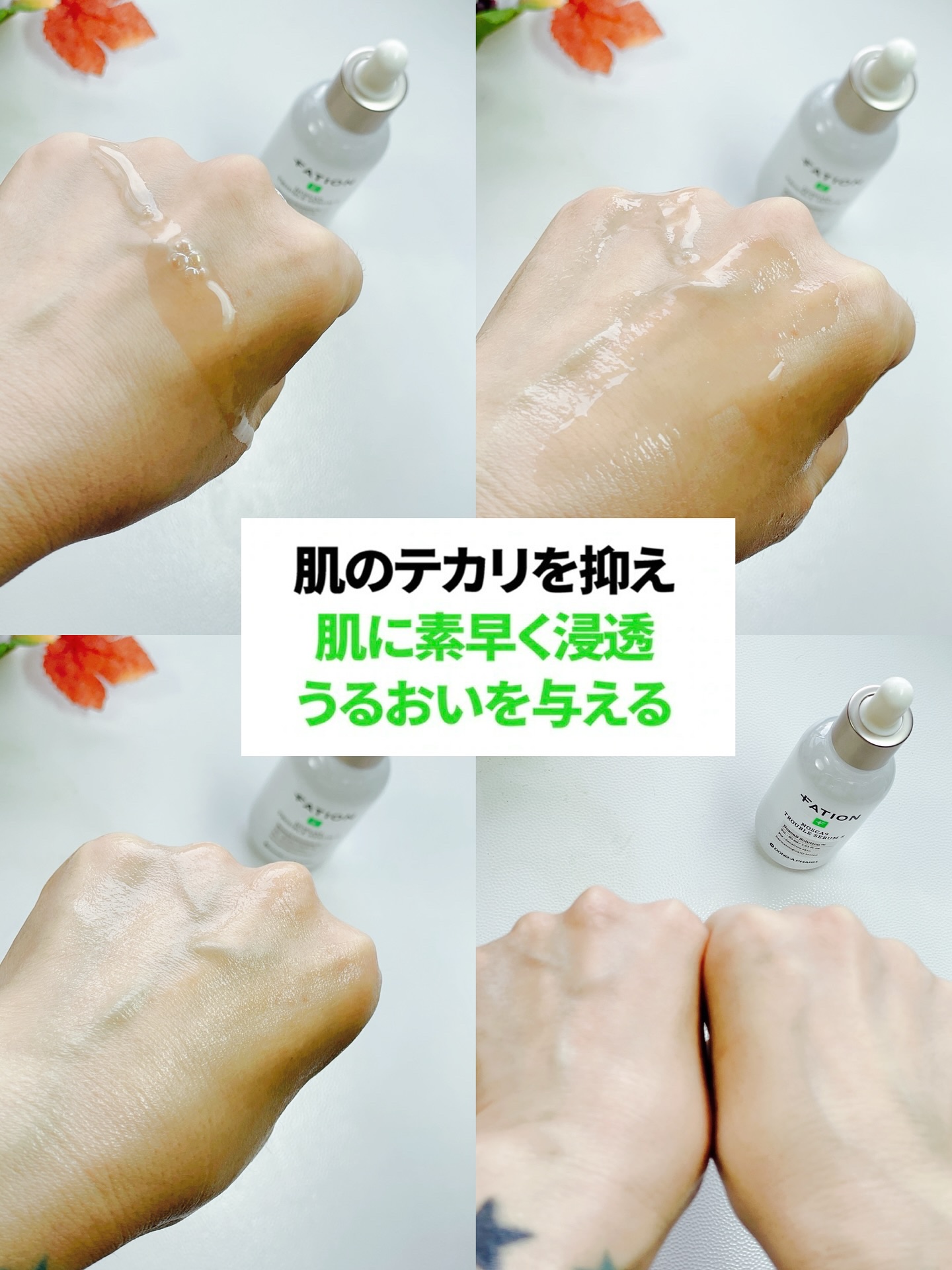 ノスカナイントラブルセラムS/FATION/美容液を使ったクチコミ（3枚目）