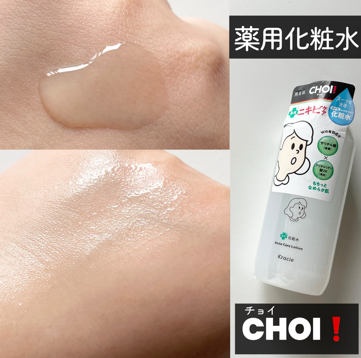 肌美精 CHOI薬用化粧水 ニキビケア[医薬部外品]/肌美精/化粧水を使ったクチコミ（1枚目）