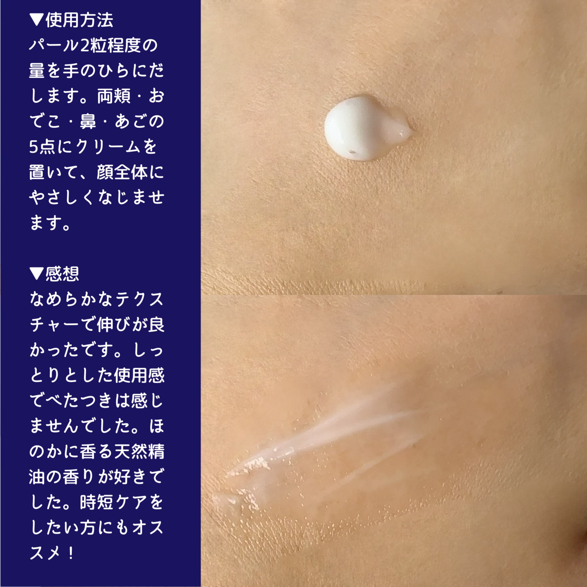 シンピ エンリッチ モイストクリーム/fracora/フェイスクリームを使ったクチコミ（3枚目）