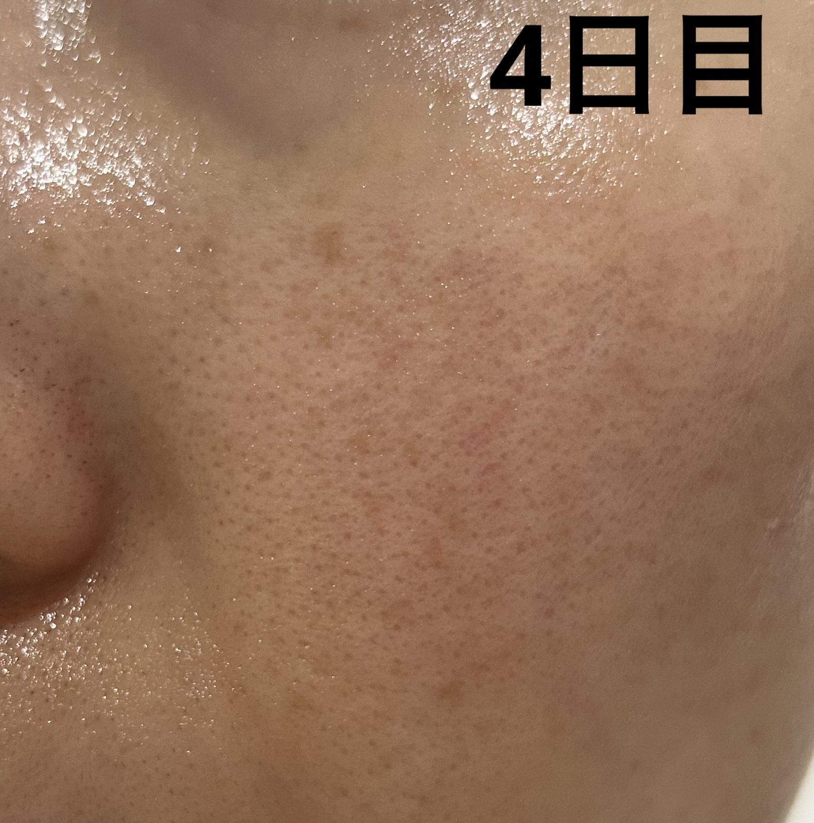 ボタニカルピール ピーリングパウダー Lv7/BOTANICAL PEEL/ピーリングを使ったクチコミ（2枚目）