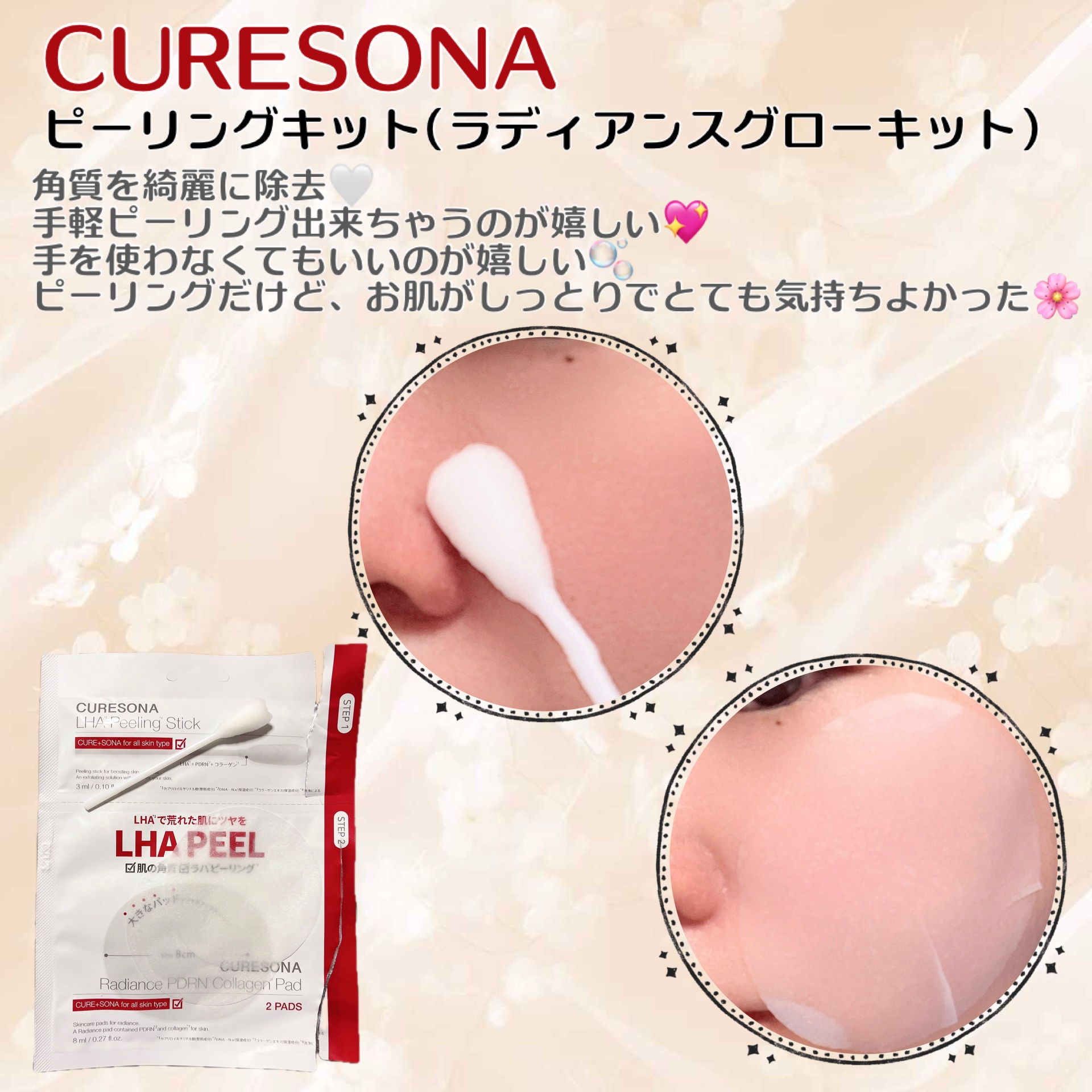 ピーリングキット ラディエンスPDRNコラーゲンパッド/CURESONA/スキンケアキットを使ったクチコミ（2枚目）