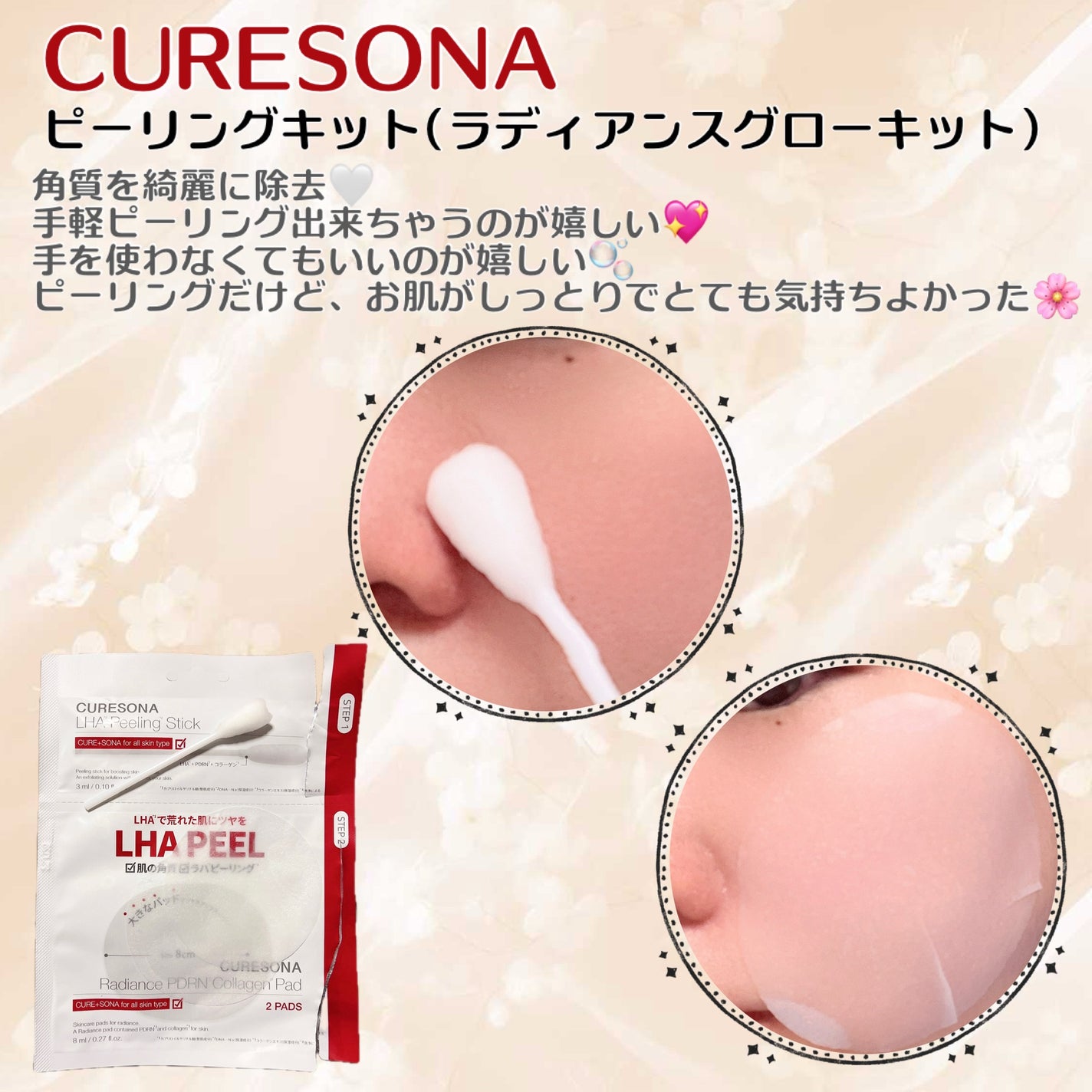 ピーリングキット ラディエンスPDRNコラーゲンパッド/CURESONA/スキンケアキットを使ったクチコミ(2枚目)