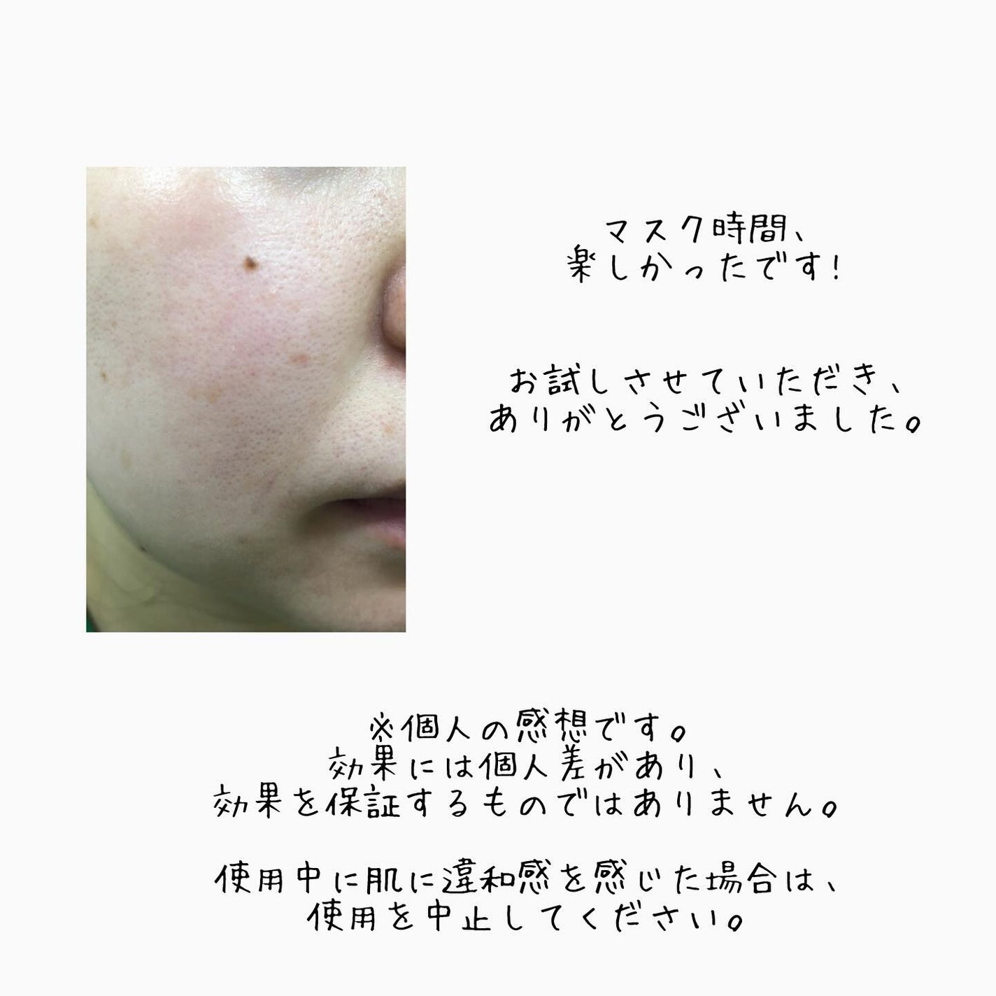 ルルルン ハイドラ AZ マスク/ルルルン/シートマスク・パックを使ったクチコミ(3枚目)