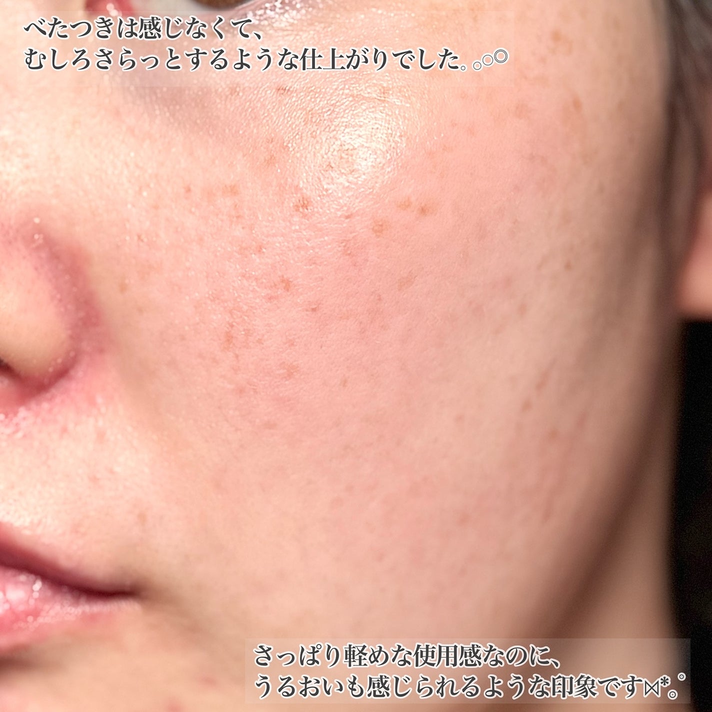 SOOTHE FORTE SERUM/essenciel/ブースター・導入液を使ったクチコミ(5枚目)