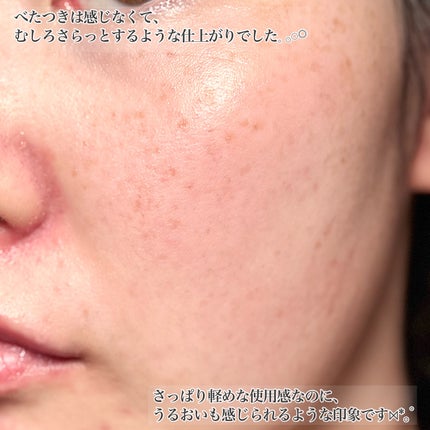 SOOTHE FORTE SERUM/essenciel/ブースター・導入液を使ったクチコミ(5枚目)