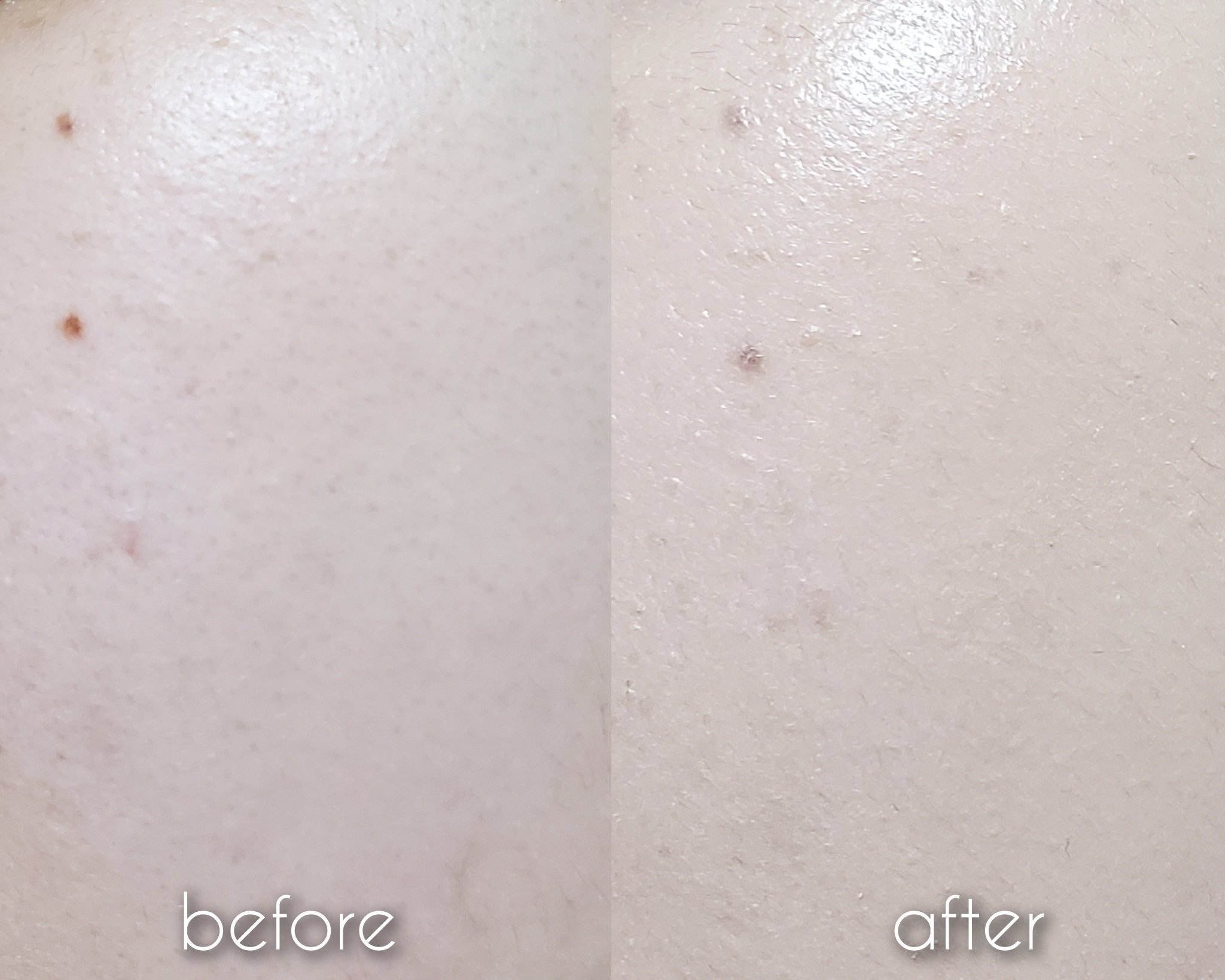 アイシーフィットカバークッションEX/TFIT/クッションファンデーションを使ったクチコミ（3枚目）