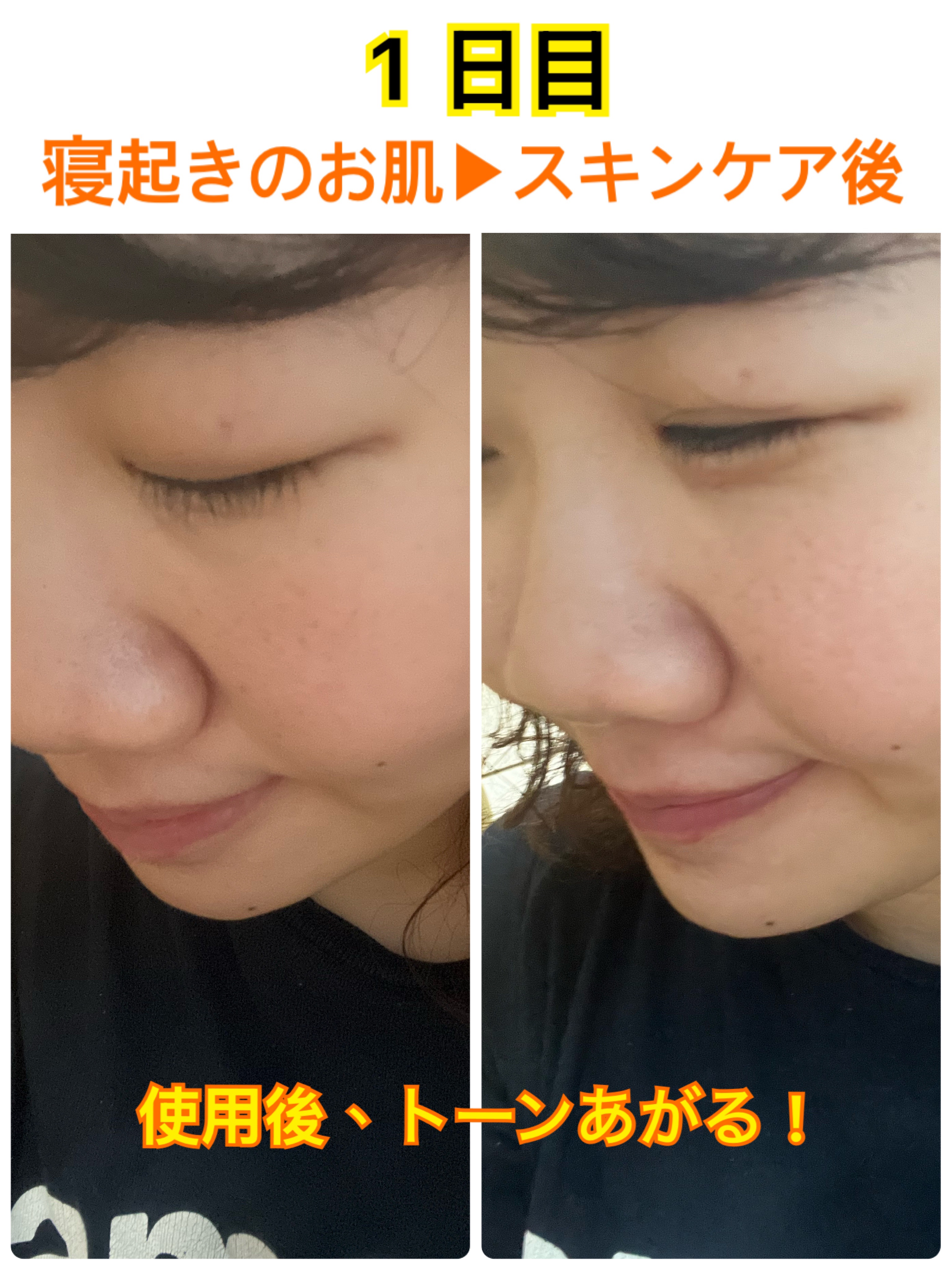 ユース パワー エッセンス ローション/DECORTÉ/化粧水を使ったクチコミ（2枚目）