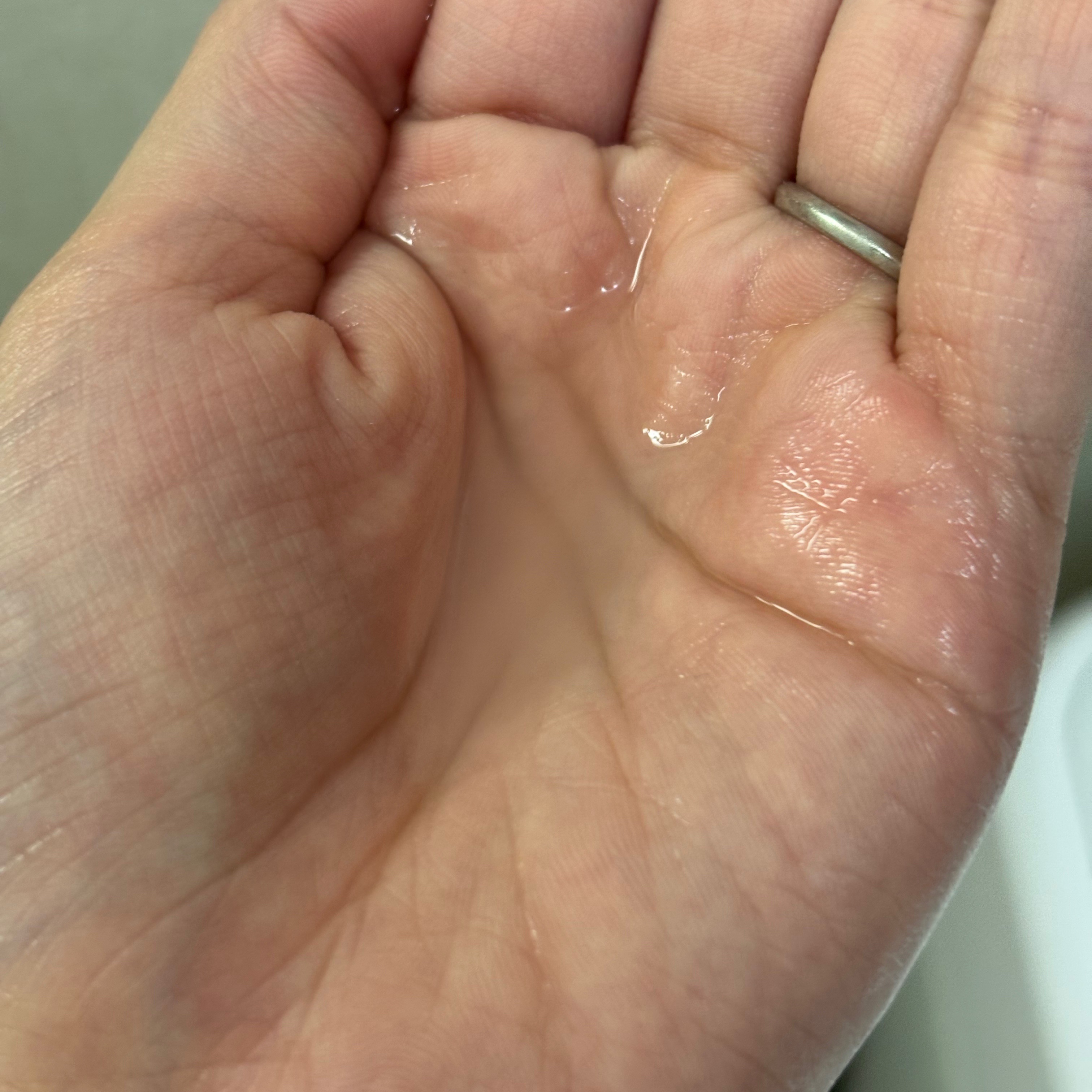 肌美精 CHOI薬用化粧水 ニキビケア[医薬部外品]/肌美精/化粧水を使ったクチコミ（2枚目）