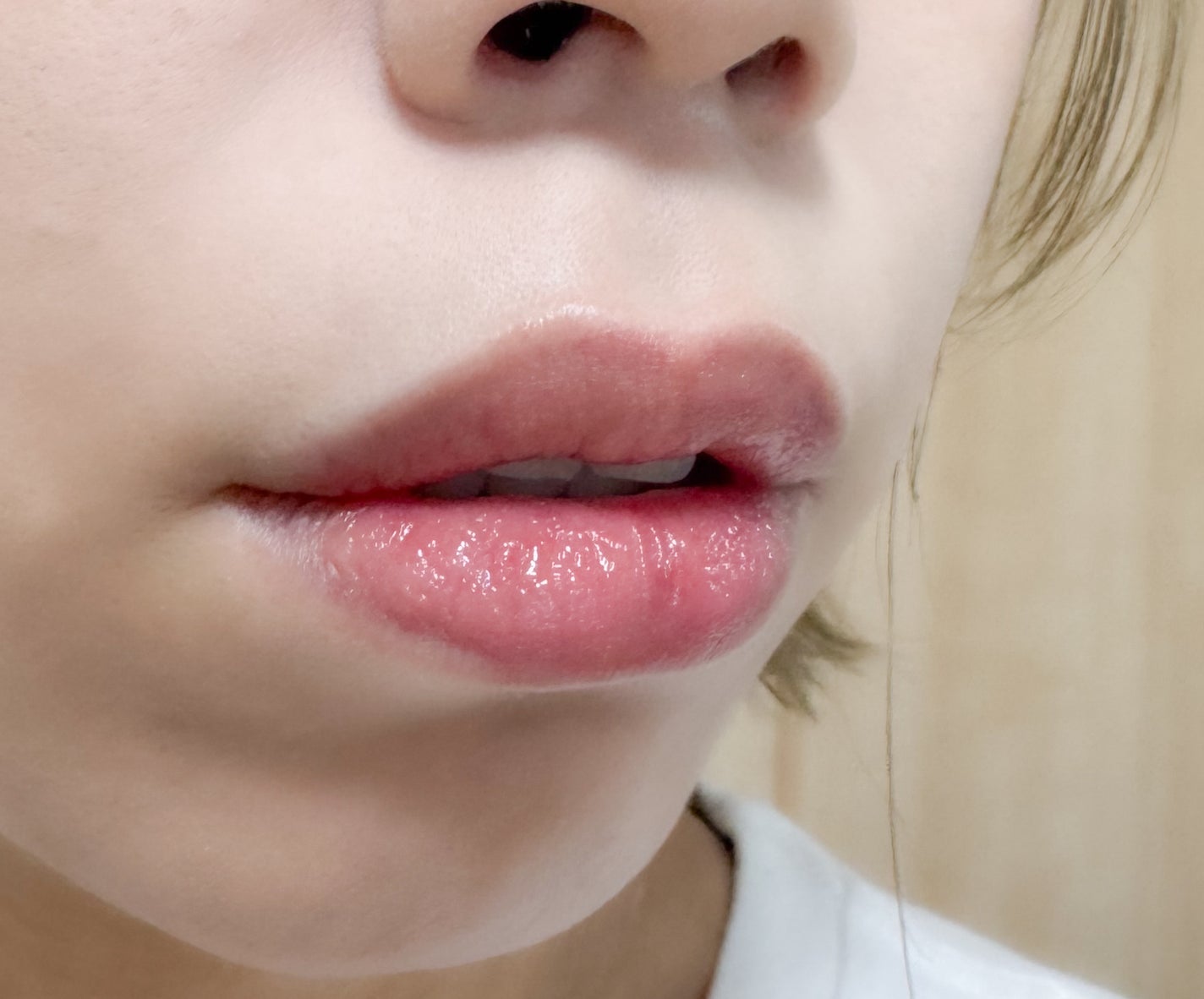 グロウラッピングティント/LIPGUARDIAN/リップティントを使ったクチコミ(4枚目)