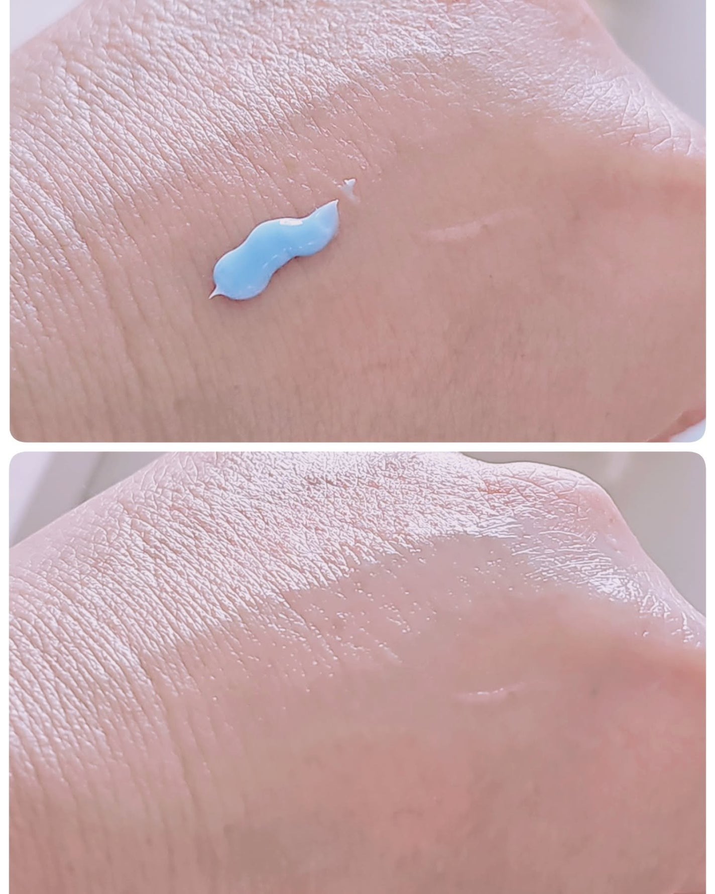 PHセンシティブスポットクリーム/SAM'U/フェイスクリームを使ったクチコミ(6枚目)