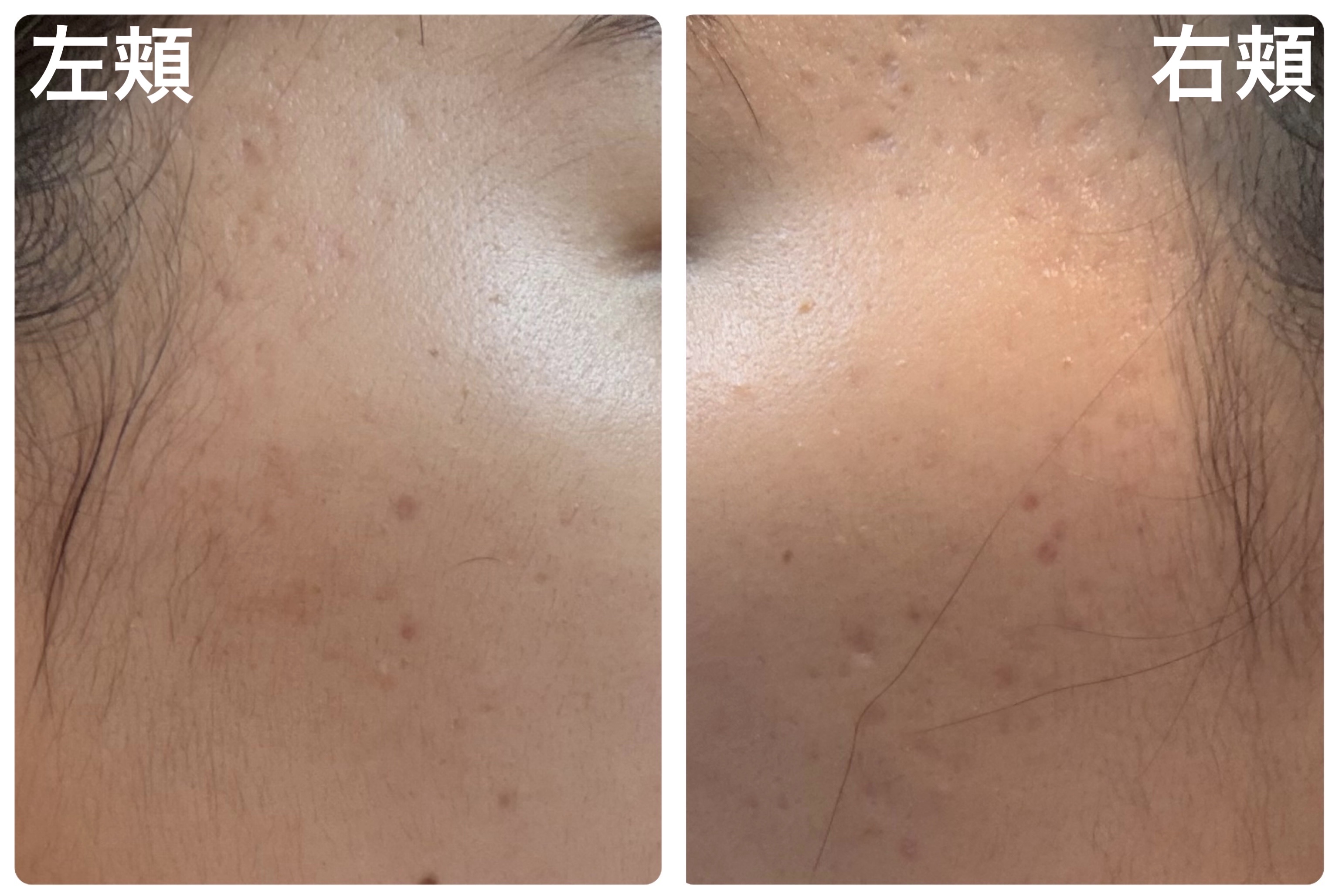 ザ・タイムR アクア/IPSA/化粧水を使ったクチコミ（2枚目）