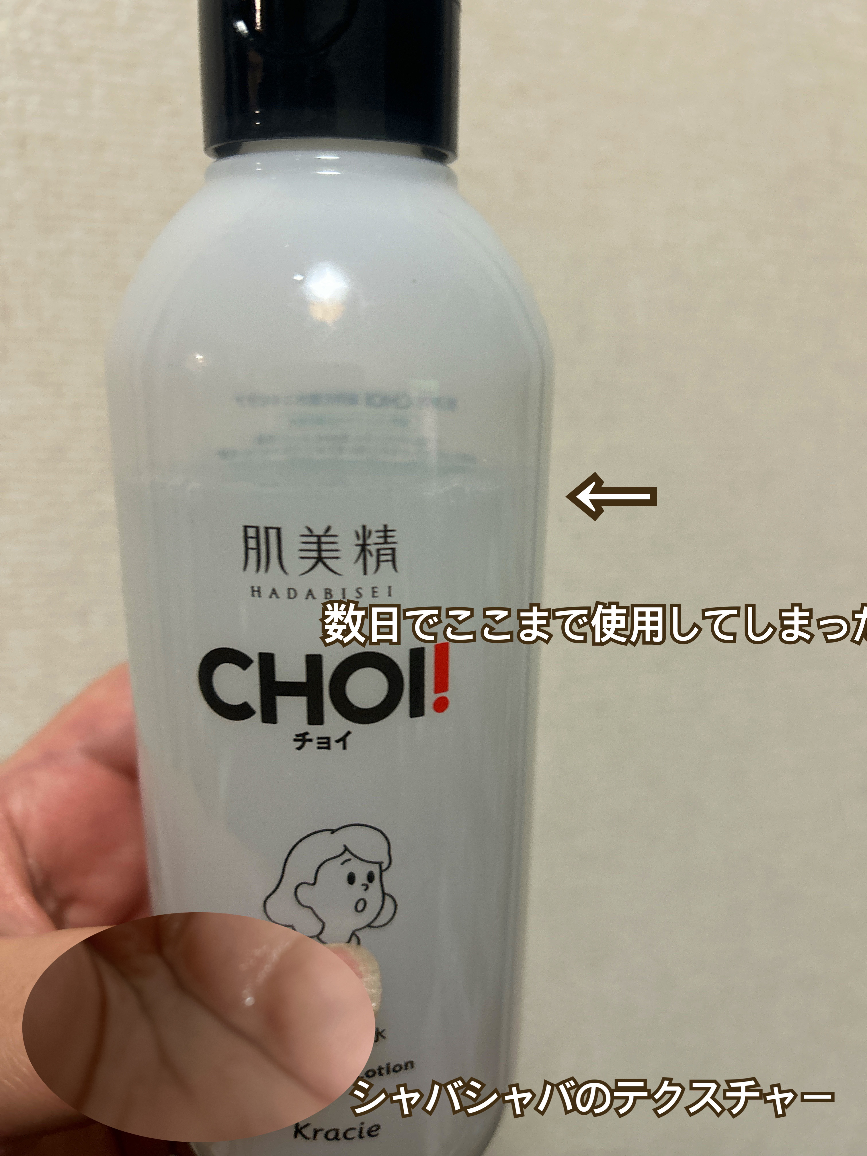 肌美精 CHOI薬用化粧水 ニキビケア[医薬部外品]/肌美精/化粧水を使ったクチコミ（2枚目）