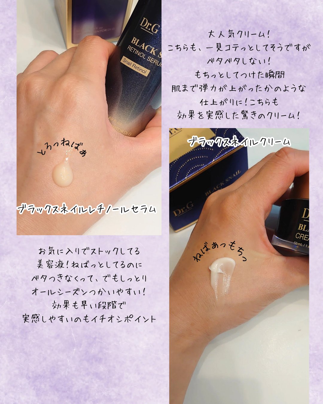 ブラックスネイル クリーム/Dr.G/フェイスクリームを使ったクチコミ（3枚目）
