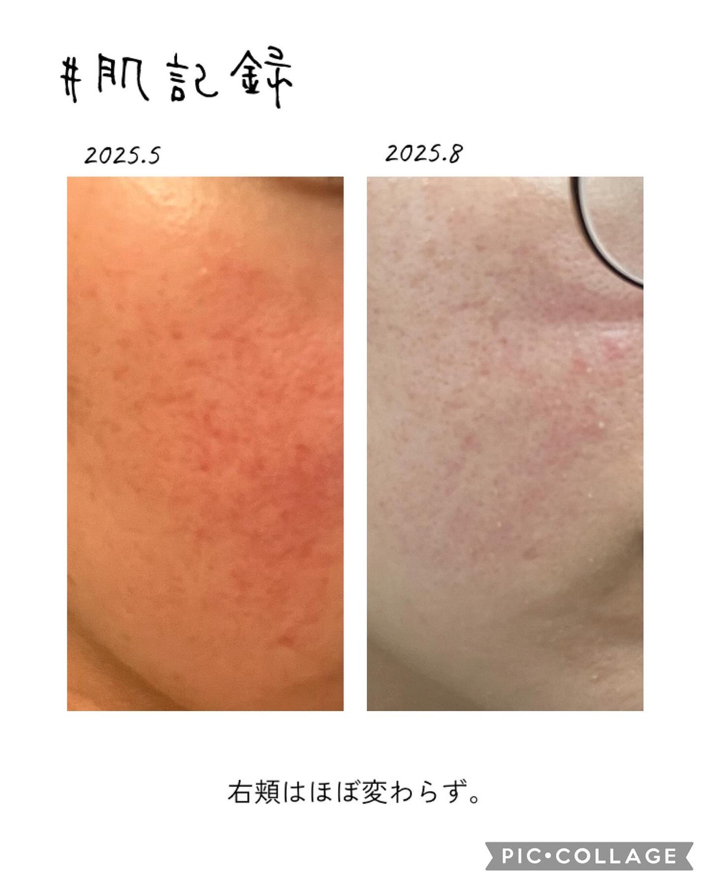 DHC 亜鉛/DHC/健康サプリメントを使ったクチコミ(5枚目)