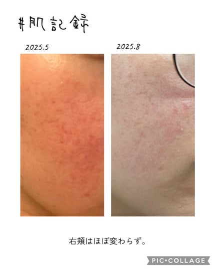 DHC 亜鉛/DHC/健康サプリメントを使ったクチコミ(5枚目)