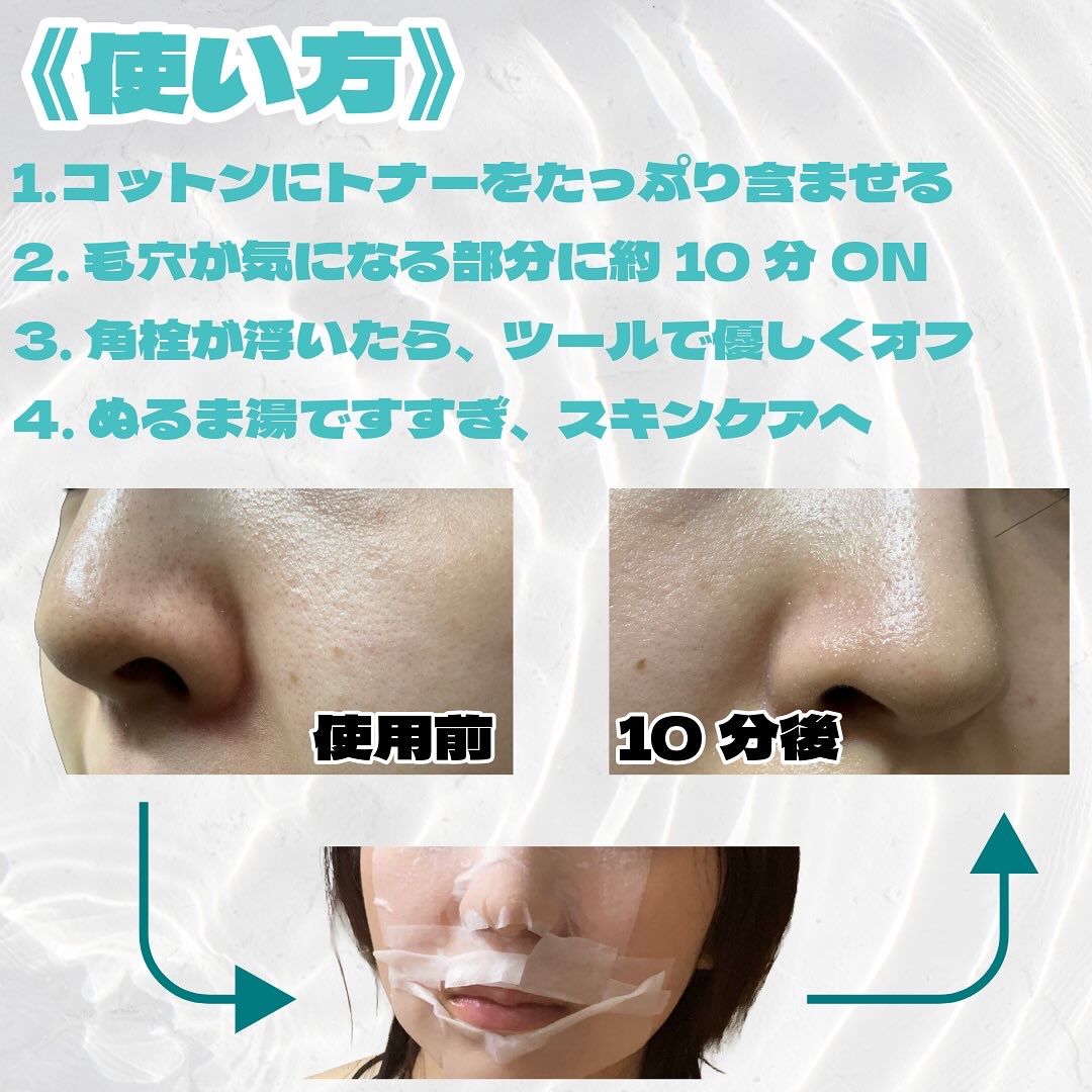 ナチュラルマイルドクリアノーズパック/ilso/シートマスク・パックを使ったクチコミ（3枚目）