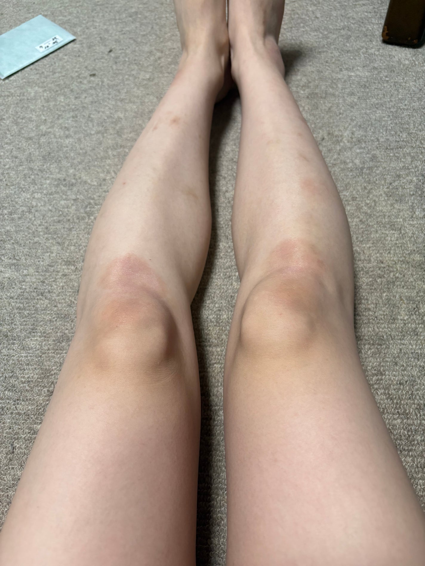 ハム太郎 on LIPS 「8.3~8.16日リアル記録#SHEIN購入品#黒ずみ..」(1枚目)