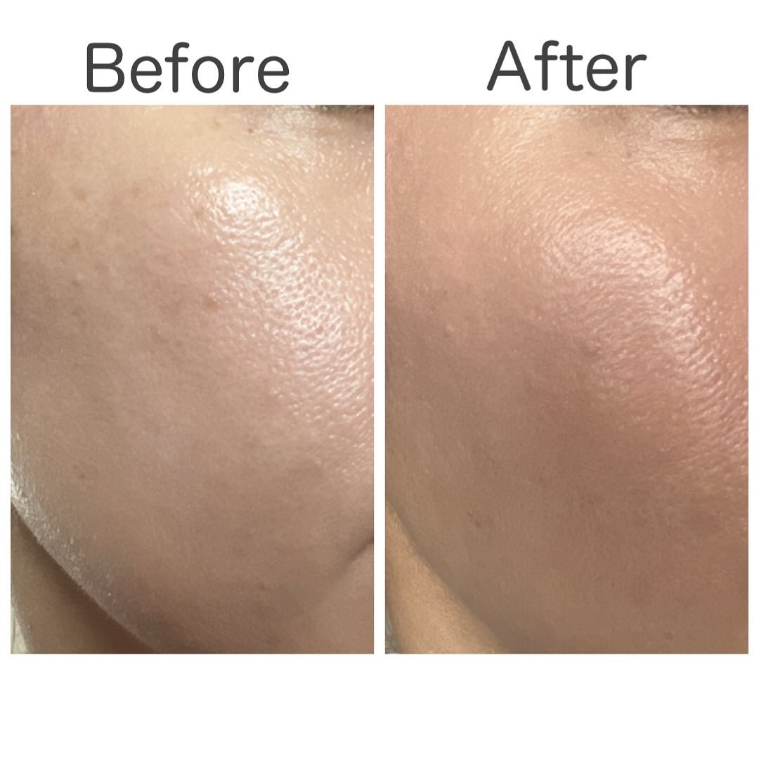 カモフラージュ コンシーラーチーク/ブリリアージュ/クリームコンシーラーを使ったクチコミ(8枚目)