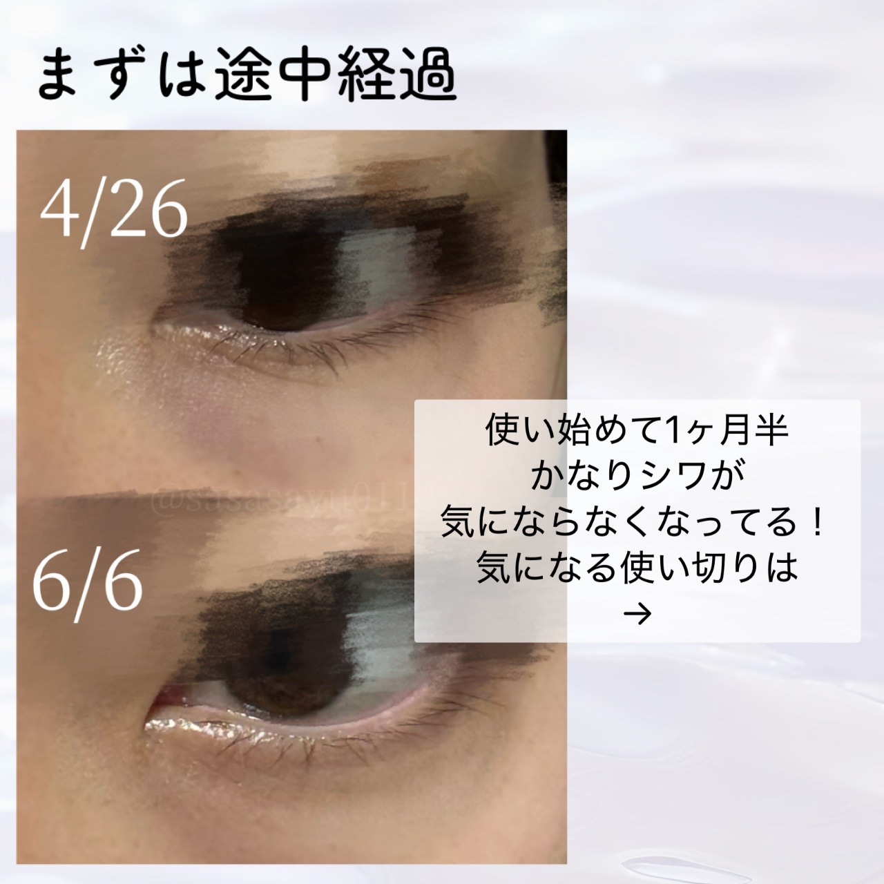 アスタリフト ザ セラム リンクルリペア 夜用 のクチコミ「シワ改善アイクリーム👀4ヶ月使ってみた結果は!?使い切りレポ⟡.·

🌟アスタリフト ザ セラ.....」（2枚目）