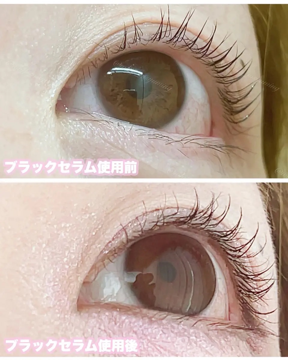アイラッシュブラックセラム/epais/まつげ美容液を使ったクチコミ（3枚目）