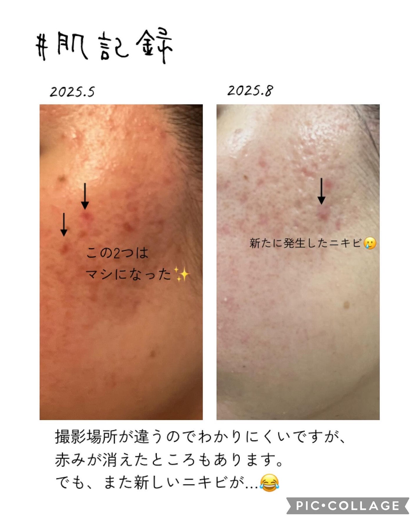 DHC 亜鉛/DHC/健康サプリメントを使ったクチコミ(4枚目)