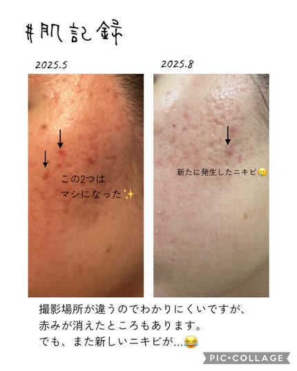 DHC 亜鉛/DHC/健康サプリメントを使ったクチコミ(4枚目)