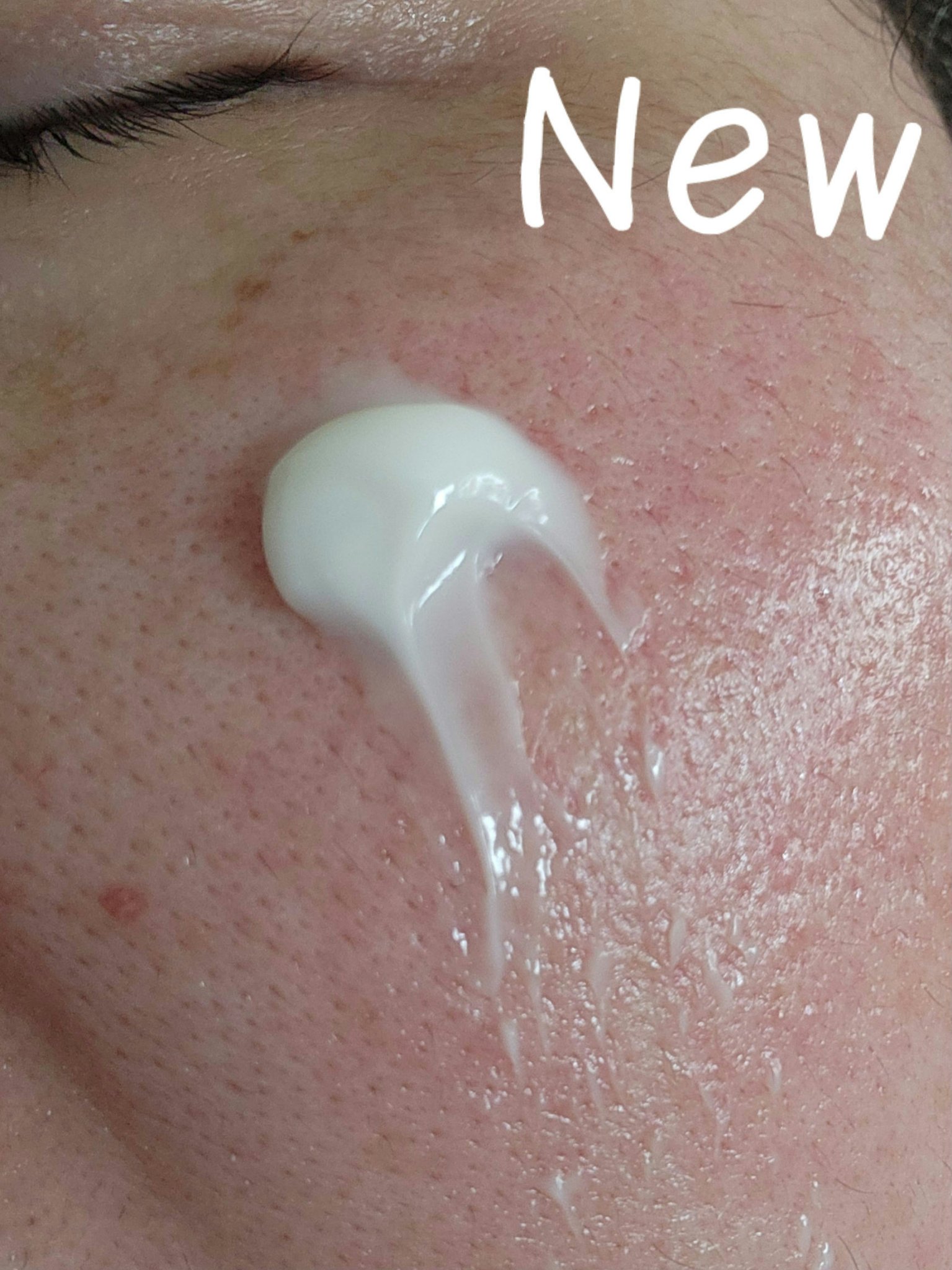 オバジC クリアアドバンスドローション/オバジ/化粧水を使ったクチコミ（3枚目）