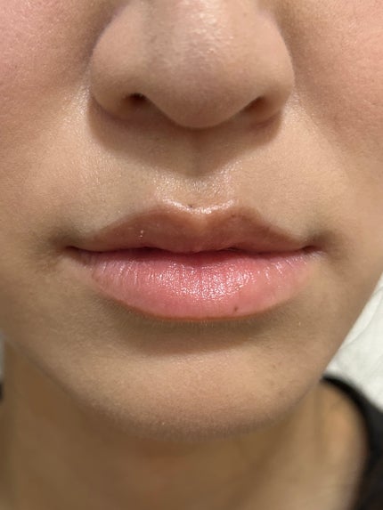 ディオール アディクト リップ グロウ 012 ローズウッド/Dior/リップバームを使ったクチコミ(3枚目)