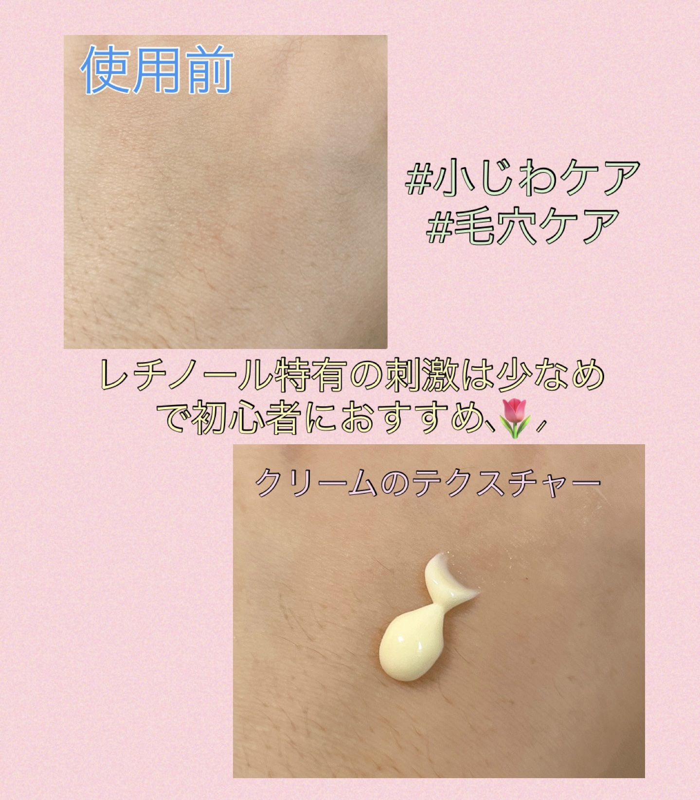 RXザ・レチノール0.1クリーム/COSRX/フェイスクリームを使ったクチコミ（2枚目）