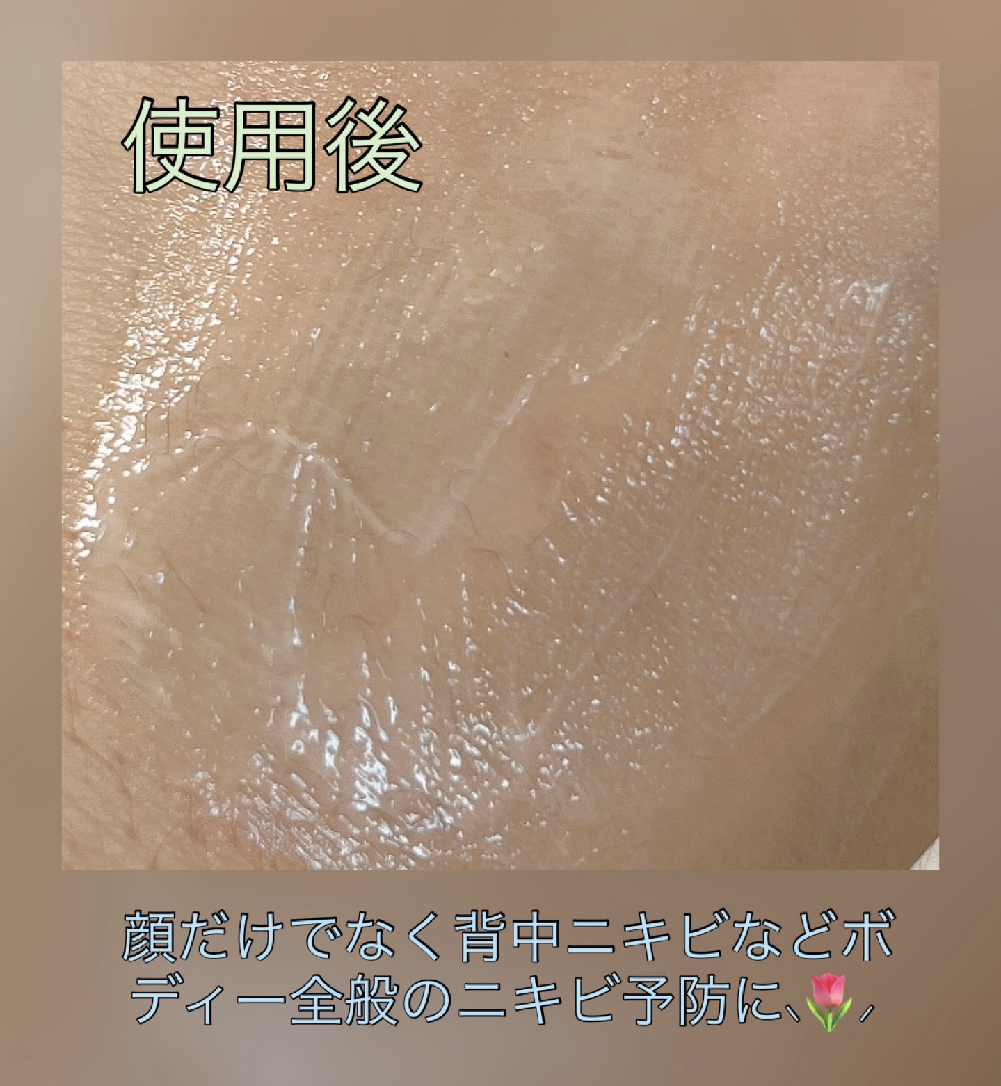 RXザ・レチノール0.1クリーム/COSRX/フェイスクリームを使ったクチコミ（3枚目）