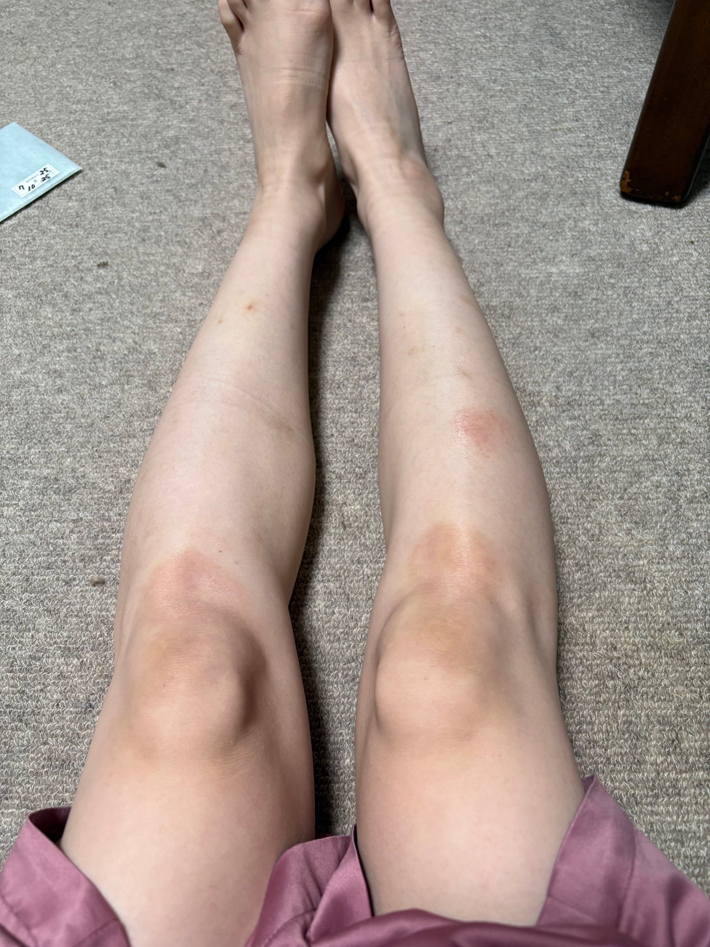 ハム太郎 on LIPS 「8.3~8.16日リアル記録#SHEIN購入品#黒ずみ..」(2枚目)