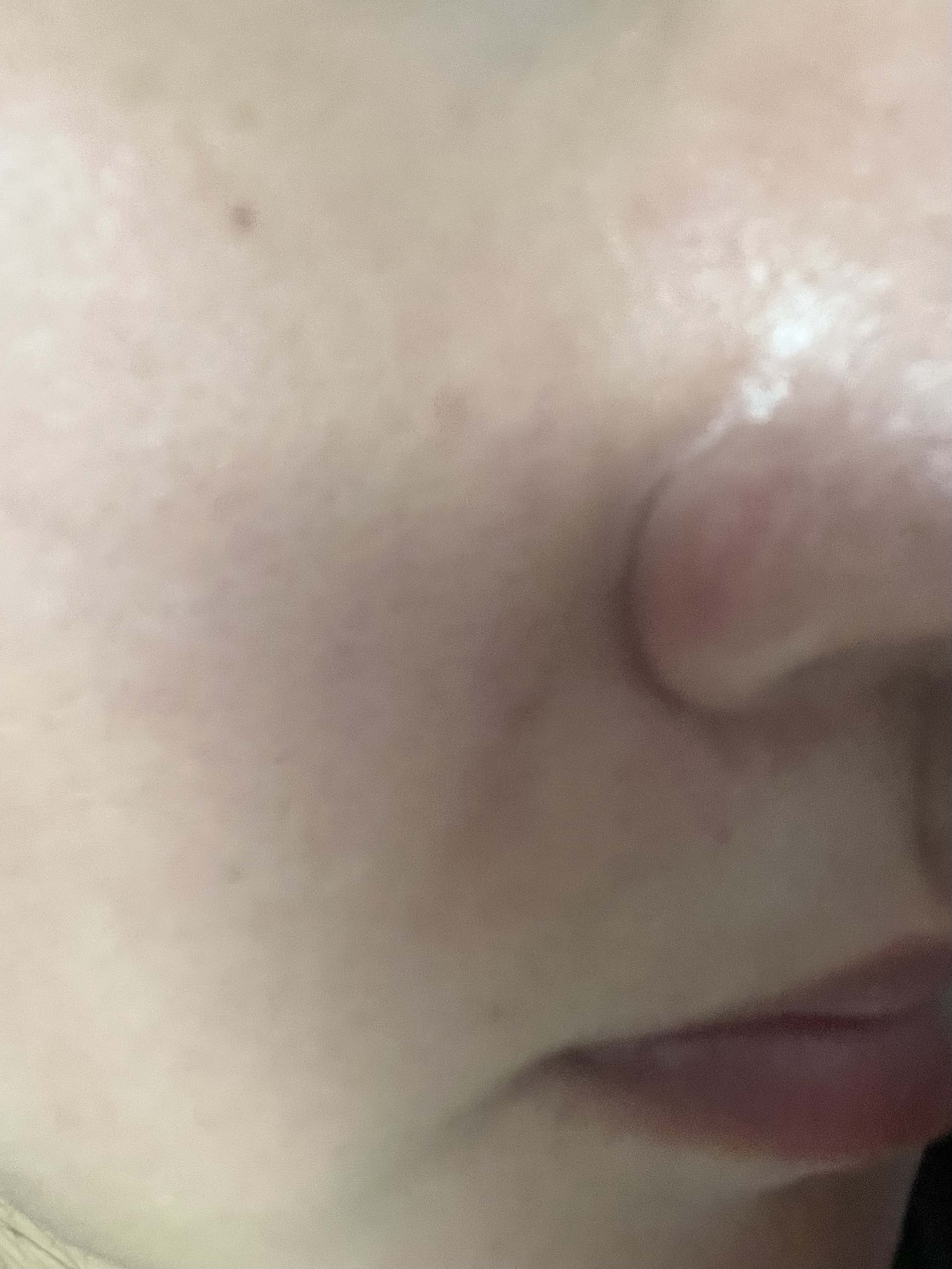 ビタ3セラム/オーズナリー/美容液を使ったクチコミ（3枚目）